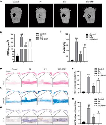 EMF treatment delays mesenchymal stem cells senescence during long-term in vitro expansion by modulating autophagy